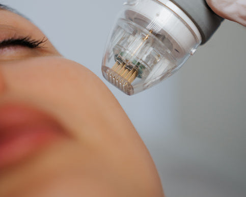 RF Skin Needling